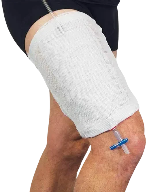 Urine Bag Leg Holder (V1, S 20-36cm)
